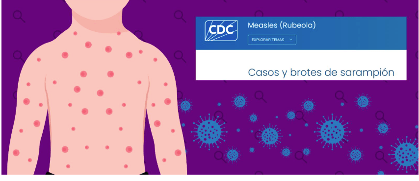 Qué sabemos sobre los brotes de sarampión detectados en Estados Unidos y cómo proteger a tu hijo de esta&nbsp;enfermedad